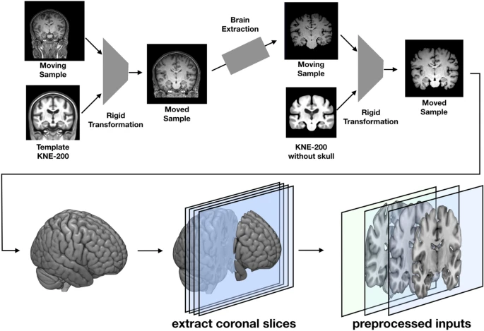 Brain Disease Classification